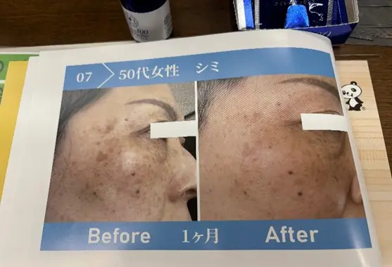 奇跡のオイルで夏のケアを！プレゼント実施中（8月10日まで） - マギヤ薬局