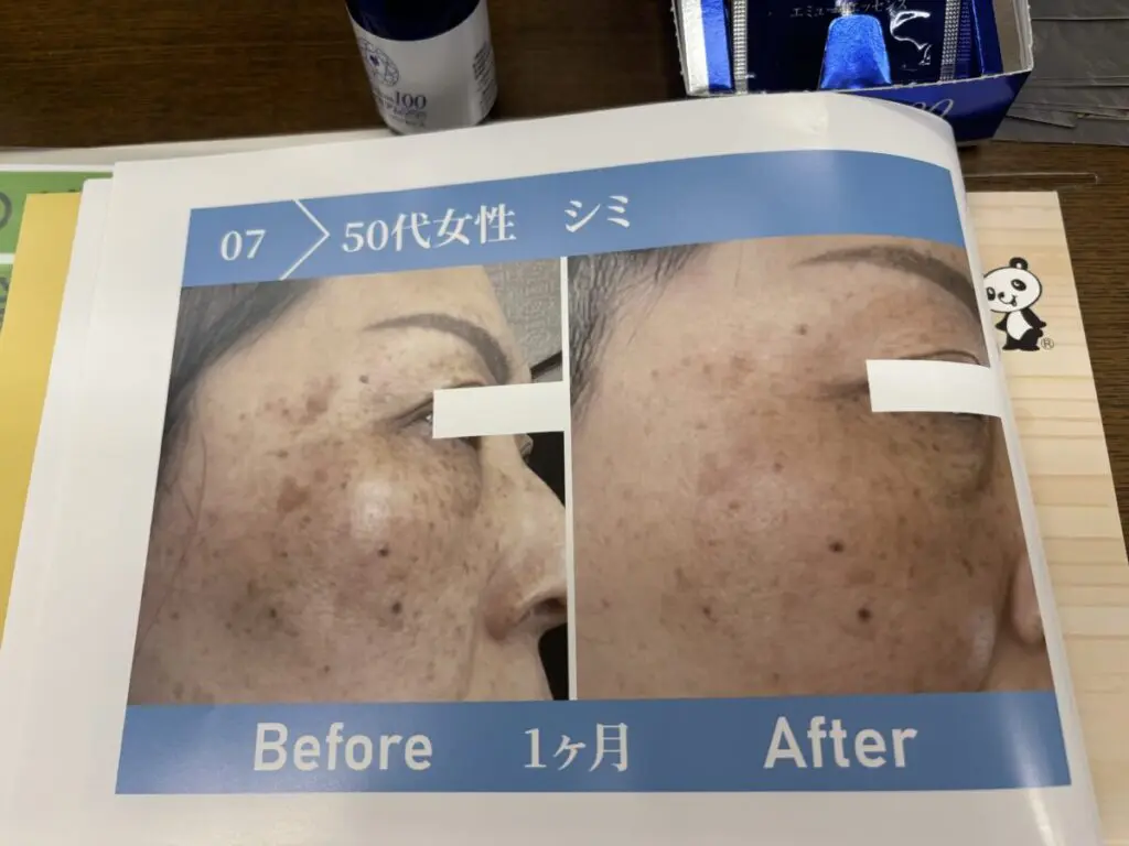 マギヤ薬局イチオシ凄オイル「プレミアム100エミューエッセンス」で  